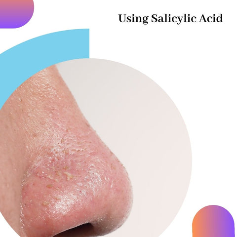 Using Salicylic Acid