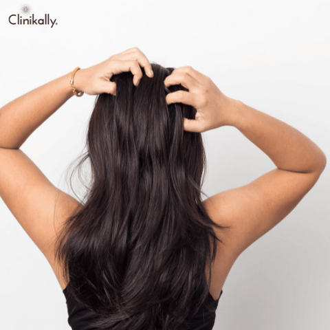 iron deficiency hair loss