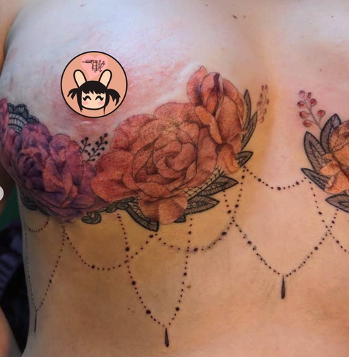 The tattoos that turn breast cancer surgery scars into works of art | Breast  cancer | The Guardian