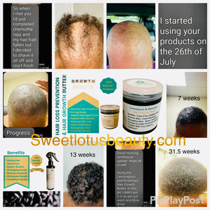 Hair Loss Prevention & Hair Growth Butter – Sweet Lotus Beauty LLC
