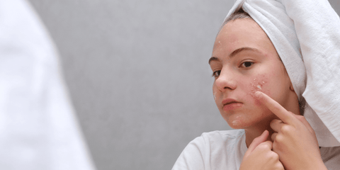how-to-care-for-'maskne'-and-other-mask-wearing-skin-concerns