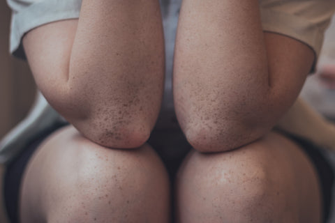 Up close shot of a woman's elbows and knees
