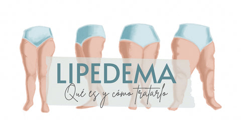 lipedema que es y como tratarlo