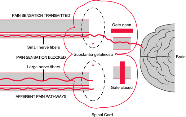 The Two-Gate theory of acupuncture for treating pain