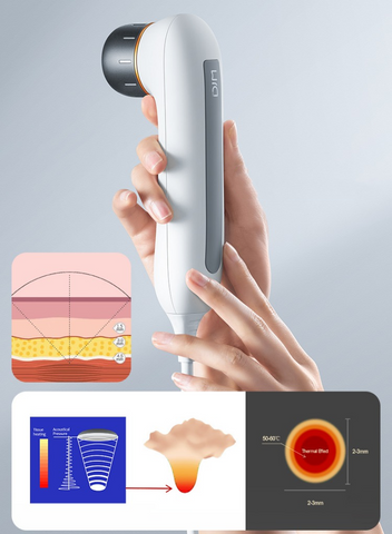 DJM Ultrasonic Cannon Anti-Aging RF Beauty Device