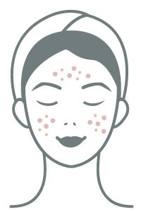 Probiotic Skincare For Acne