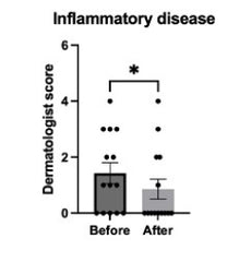 inflammatory disease