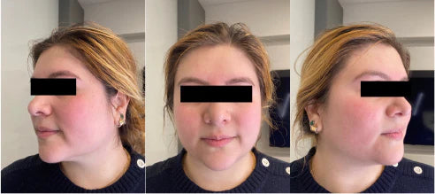 participant_1_after.webp__PID:70af4215-9df9-4459-8484-e441db147328