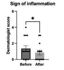 sign of inflammation