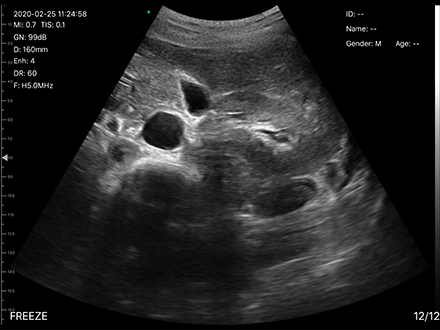 Eagleview ultrasound crystal-clear images 
