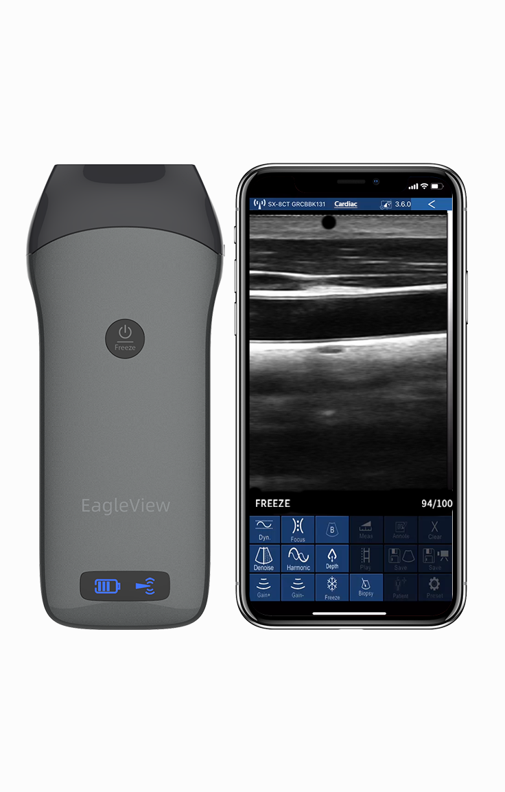 eagleview linear ultrasound probe with scanning image.png__PID:4e2571b8-5463-4ecb-8a4d-16dc6907313d