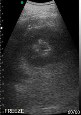 Application of EagleView Ultrasound in Emergency Cases in Small Clinics