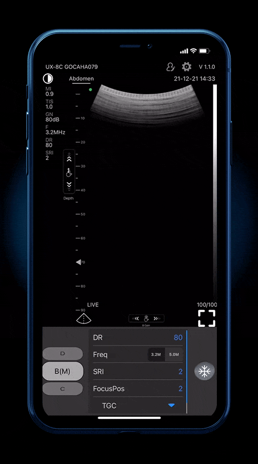 16 body presets to choose on EagleView portable doppler ultrasound, from Vascular to Cardiac.