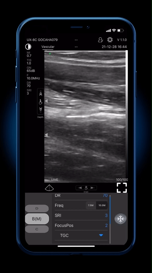 EagleView Portable Wireless Ultrasound Scanner with Linear, Convex and  Phased Array Probe. Compatible with iOS and Android.