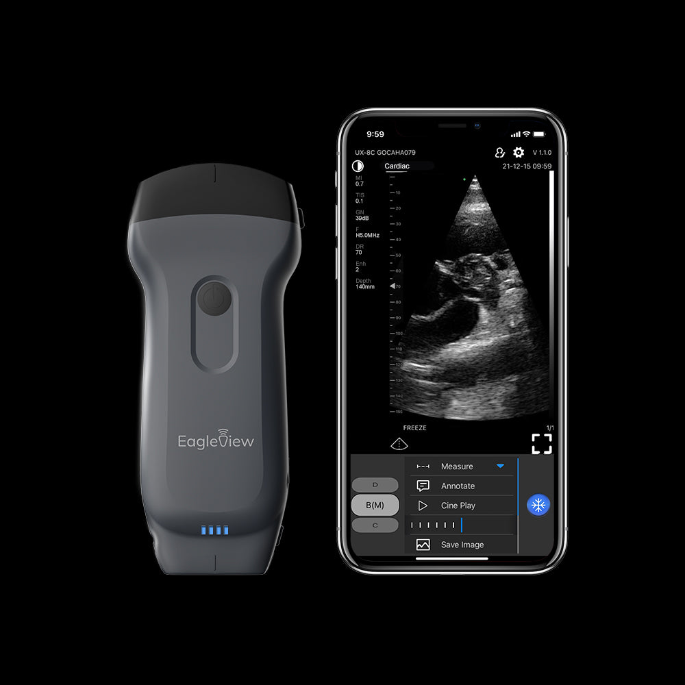 Portable Ultrasound Machines for Home or Clinic Use