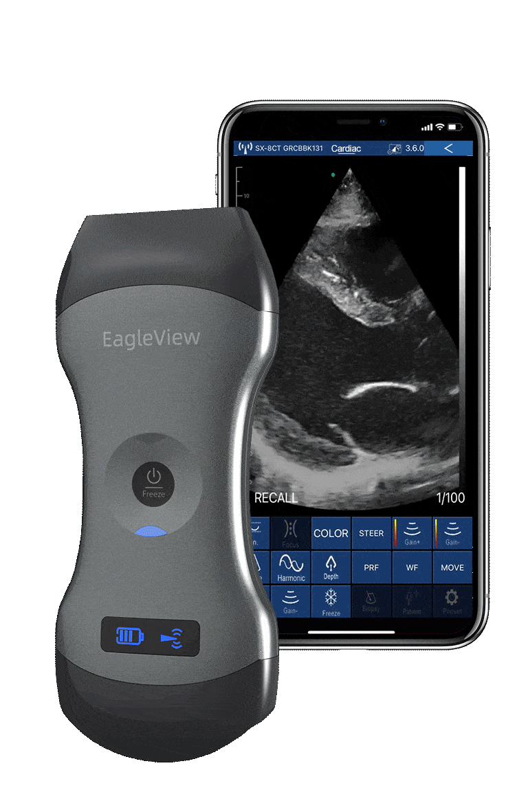 EagleView Portable Wireless Ultrasound Scanner with Linear, Convex and  Phased Array Probe. Compatible with iOS and Android.