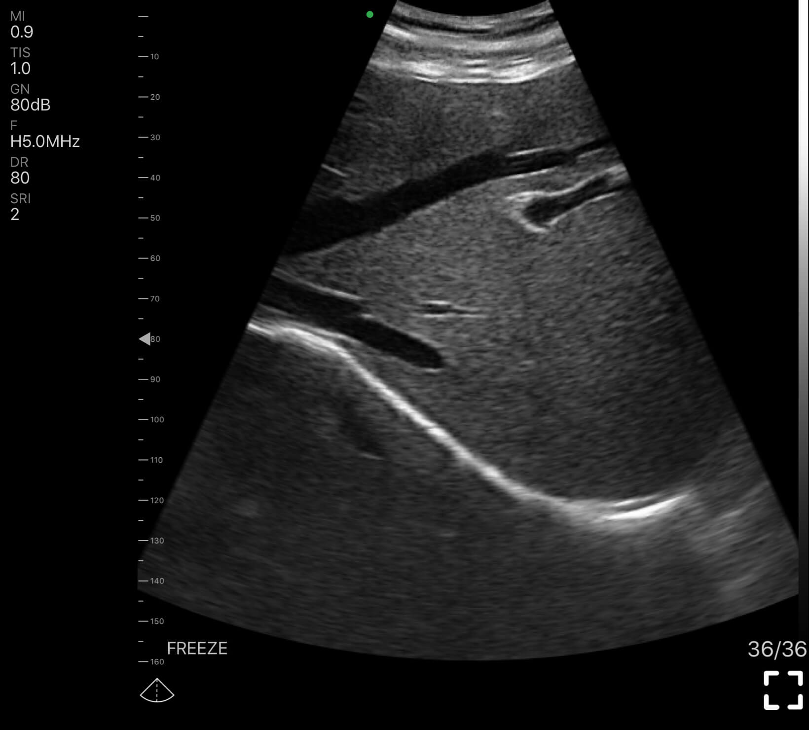 Imagerie cardiaque par échographie sans fil de poche EagleView,