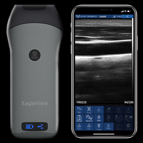 EagleView Linear Wireless Probe Type Ultrasound Scanner