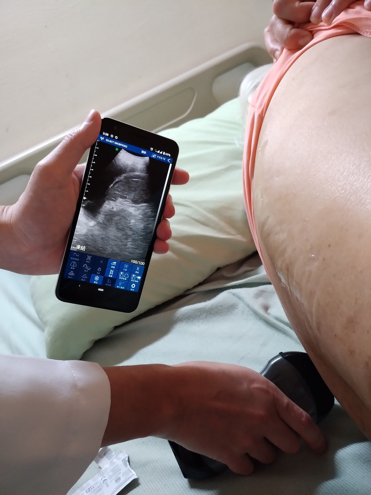 EagleView ultrasound is ultilized in many global medical practices.