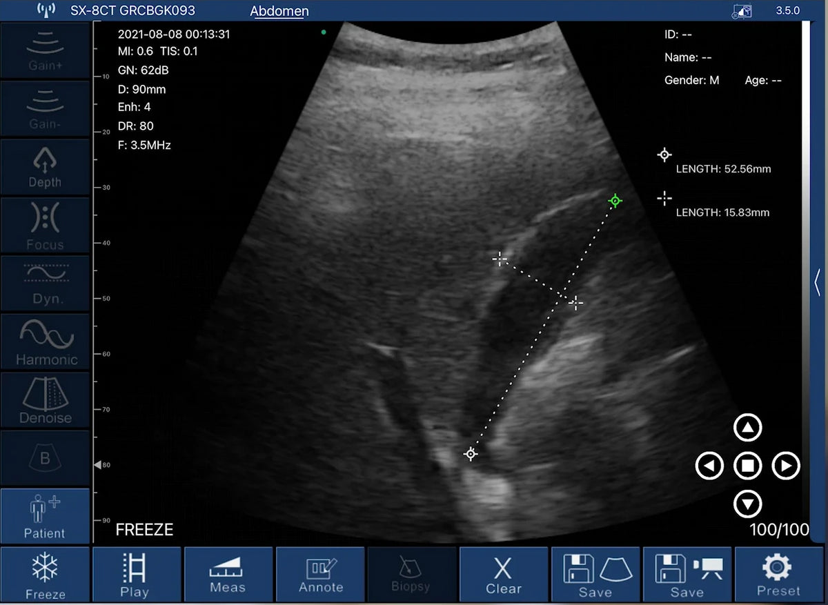 Eagleview™ Pocket Portable Doppler Ultrasound: wireless curvilinear  ultrasound probe for iPad, iPhone and Andriod Phone. – EagleView