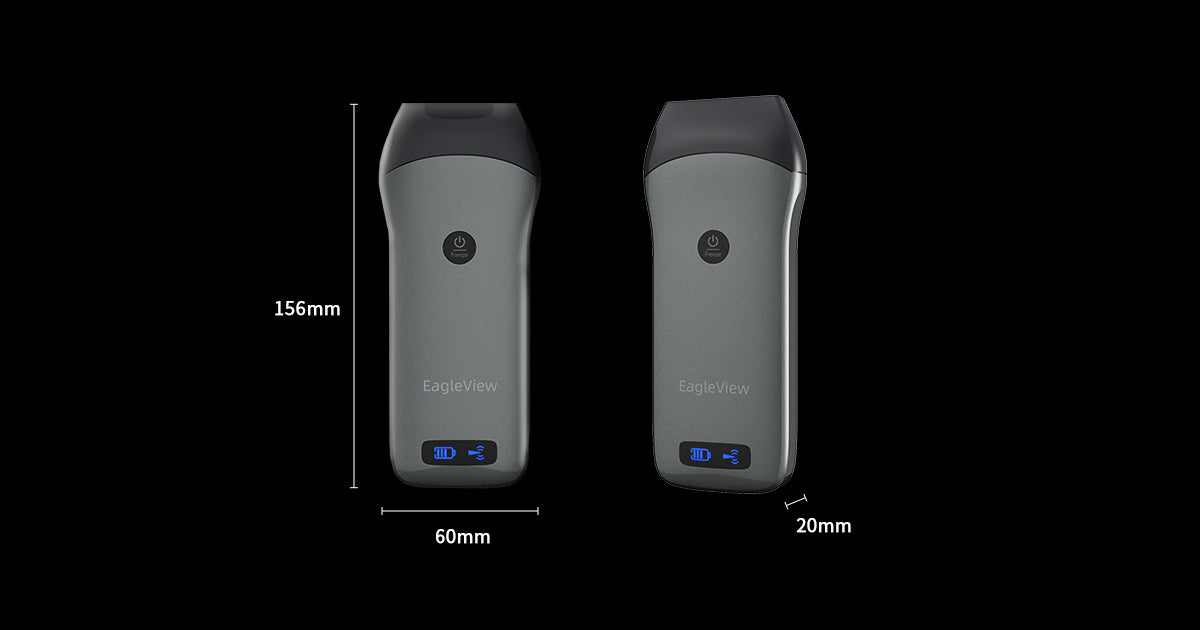 EagleView Linear Handheld Ultrasound is only a hand size.