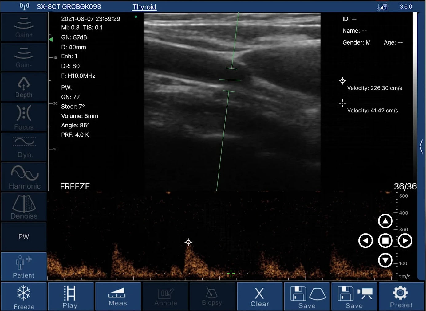 EagleView Portable Wireless Ultrasound Scanner with Linear, Convex