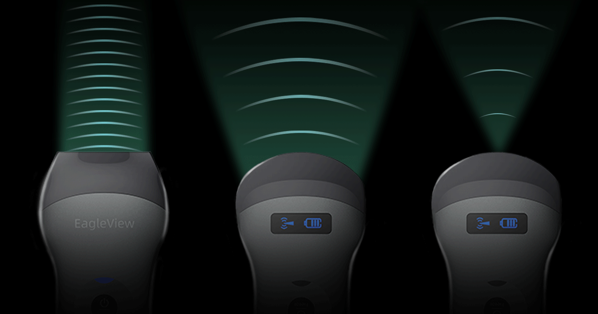 EagleView Dual-Head Handheld Ultrasound with linear, curved and phased array 3-in-1 probe.