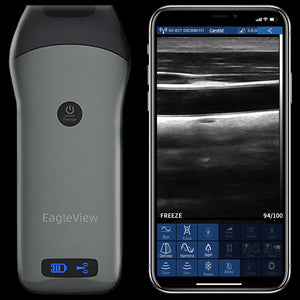 eagleview linear ultrasound probe with scanning image.png__PID:4e2571b8-5463-4ecb-8a4d-16dc6907313d