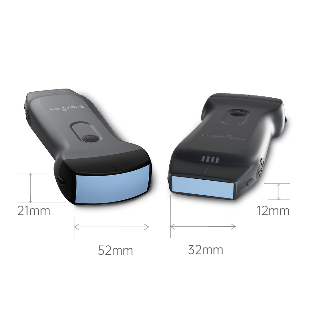 EagleView Portable Wireless Ultrasound Scanner with Linear, Convex and  Phased Array Probe. Compatible with iOS and Android.