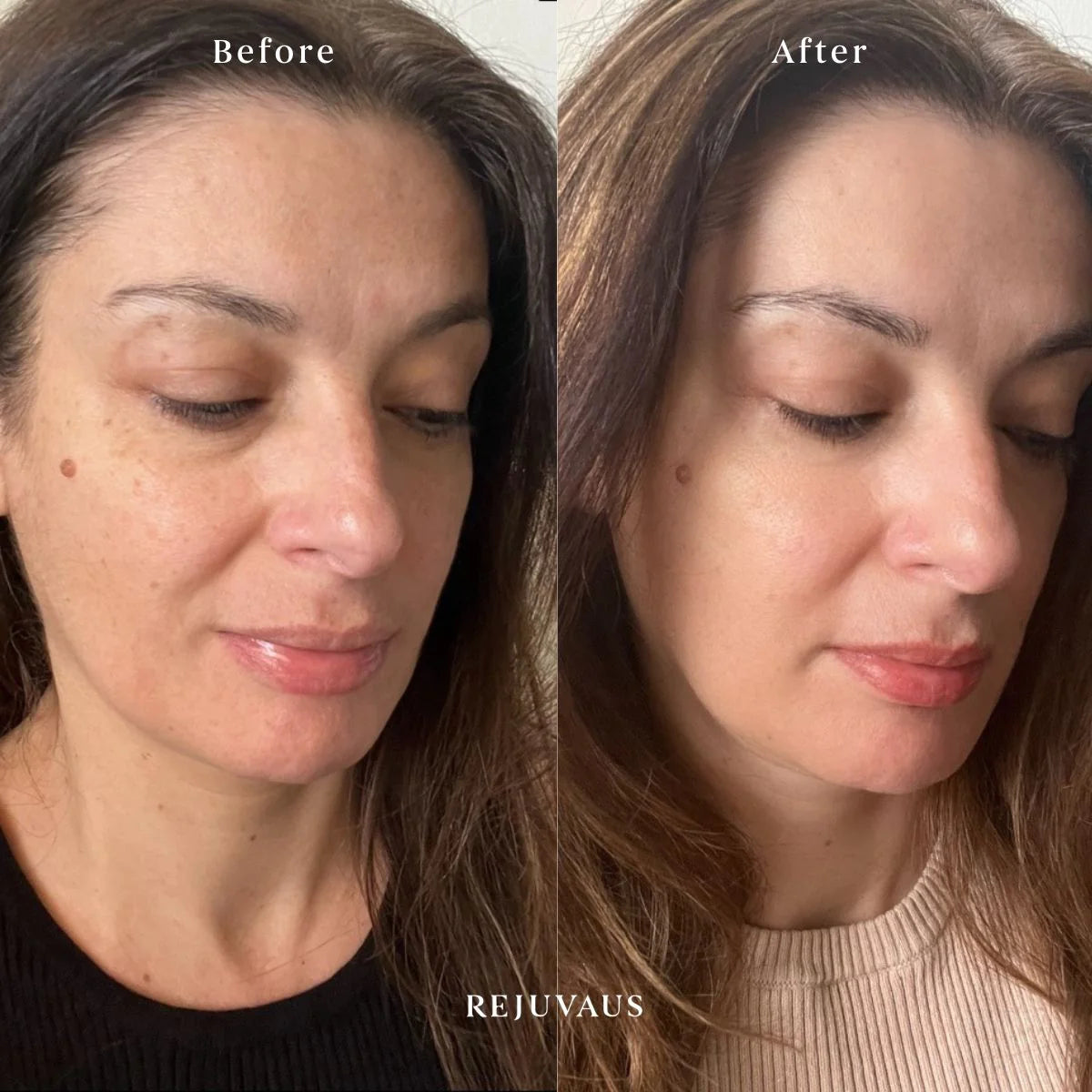 Serum for fine lines