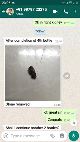 kidney stone review