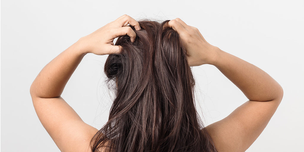 Are you ready to say goodbye to dandruff?