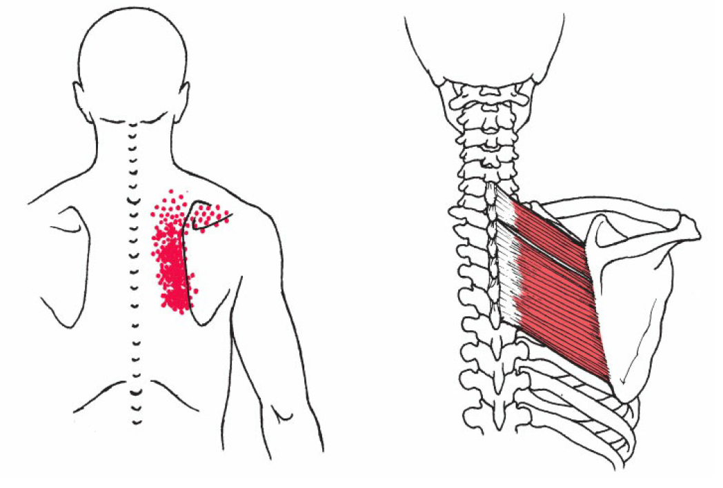 Rhomboid Muscle Pain How To Fix Pain In Shoulder Blade