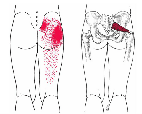 Piriformis Syndrome Test - Is Piriformis Your Pain Source?