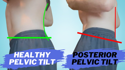 Back Pain From Poor Posture Pelvic Tilt