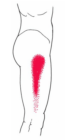 tensor fasciae latae pain pattern