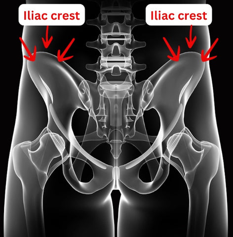 know where your iliac crest is for iliac crest pain