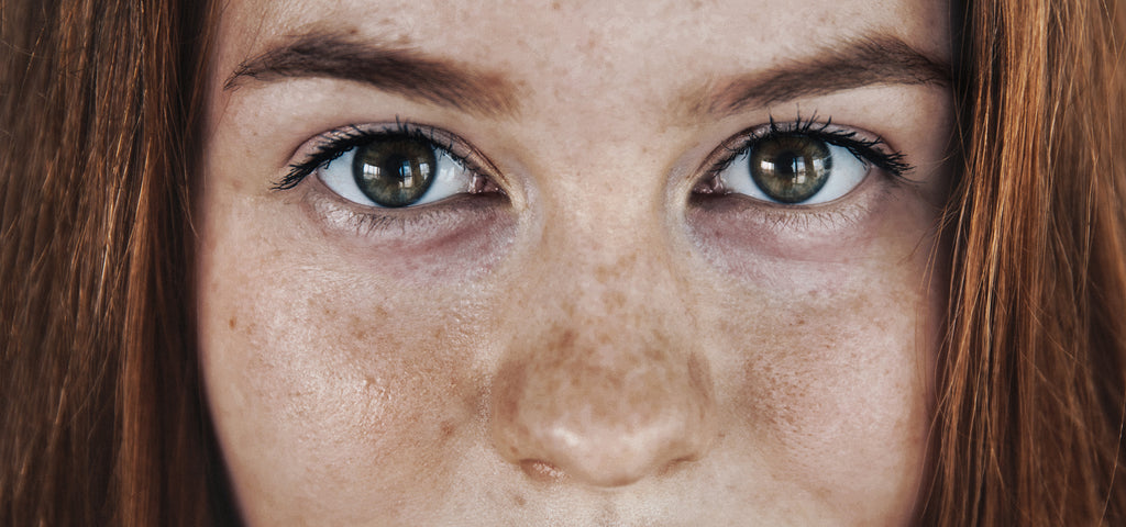 Gesichtsausschnitt von Frau mit Augenringen.