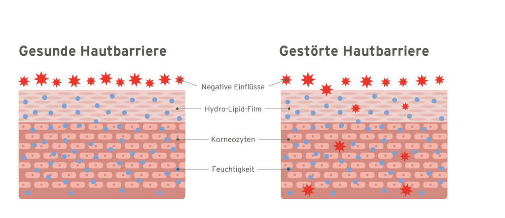 Vergleich_gestoerte_und_gesunde_Hautbarriere