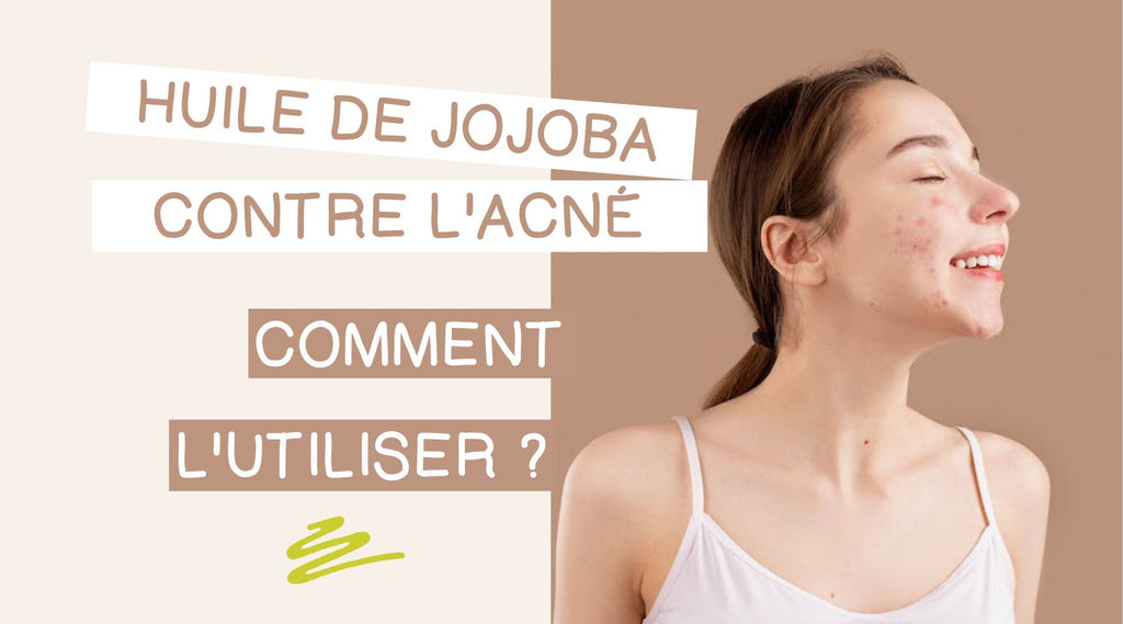 Huile de jojoba pour traiter l'acné : comment l'utiliser dans sa routine beauté ?