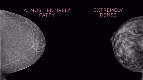 Breast density image