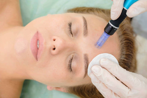 microneedling facial