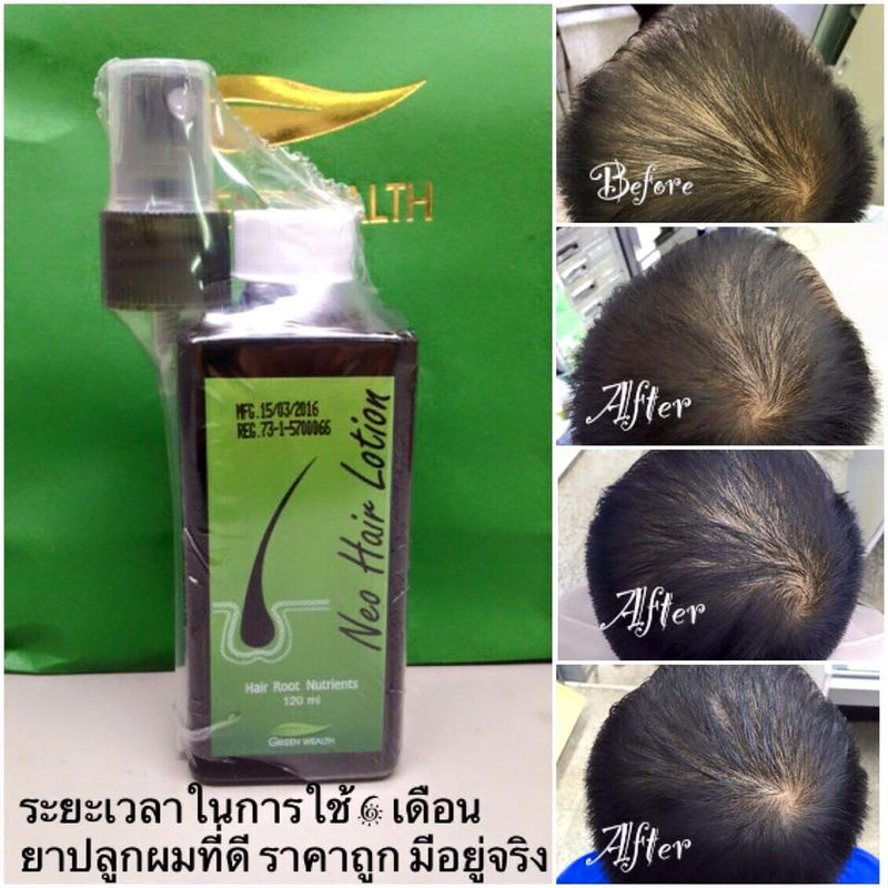 neo hair lotion