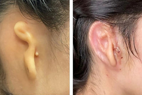 3d scanned ear