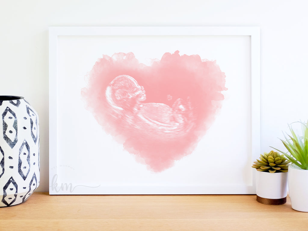 Custom ultrasound art with baby ultrasound sonogram painted inside baby shower gift