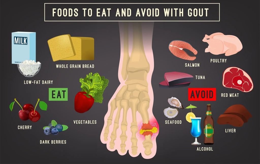 Foods to eat and avoid with gout