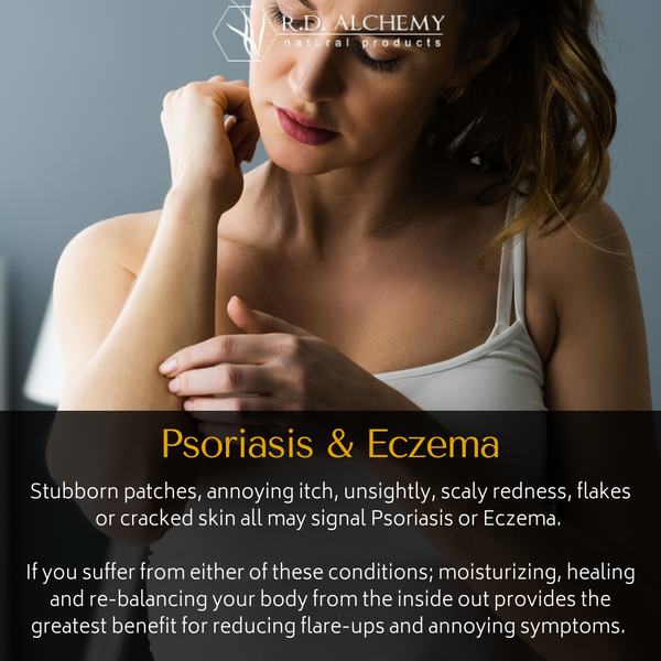 psoriasis and eczema