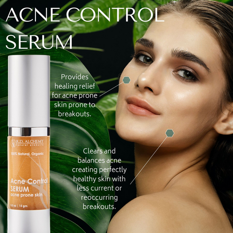 acne control serum 