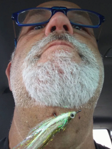 Man with fishing lure stuck in his chin