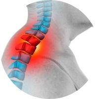 chronic neck pain